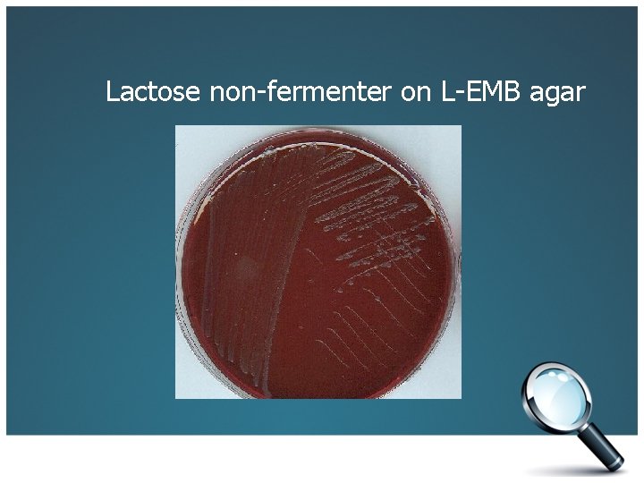 Lactose non-fermenter on L-EMB agar 