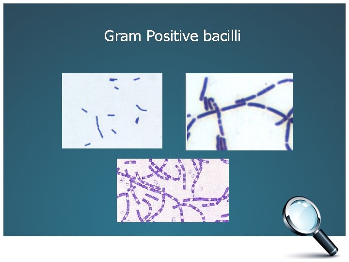 Gram Positive bacilli 