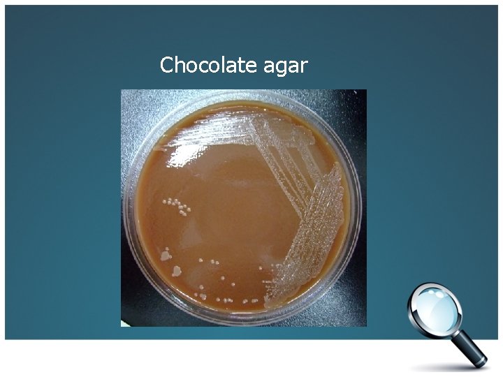 Chocolate agar 