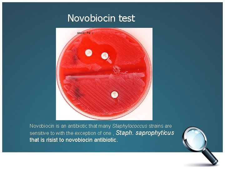 Novobiocin test Novobiocin is an antibiotic that many Staphylococcus strains are sensitive to with