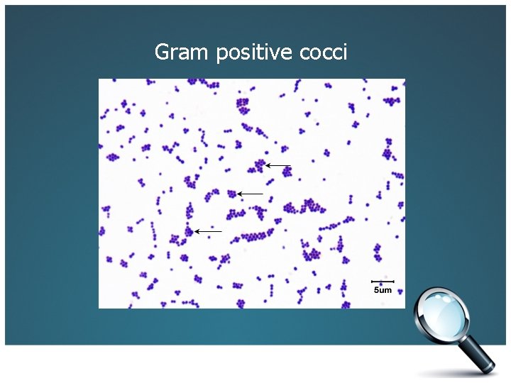 Gram positive cocci 