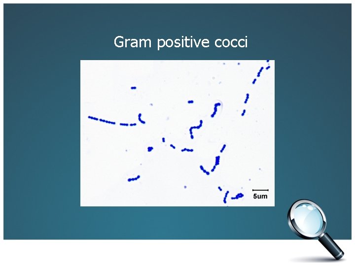 Gram positive cocci 