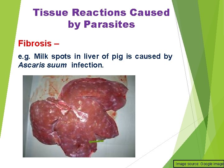 Tissue Reactions Caused by Parasites Fibrosis – e. g. Milk spots in liver of