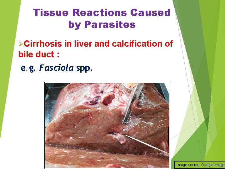 Tissue Reactions Caused by Parasites ØCirrhosis in liver and calcification of bile duct :