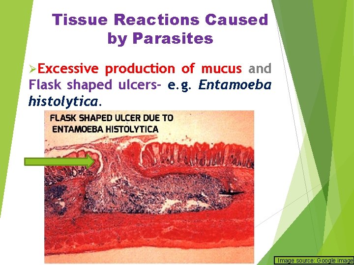 Tissue Reactions Caused by Parasites ØExcessive production of mucus and Flask shaped ulcers- e.