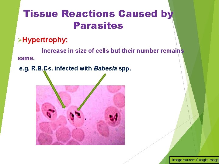 Tissue Reactions Caused by Parasites ØHypertrophy: Increase in size of cells but their number
