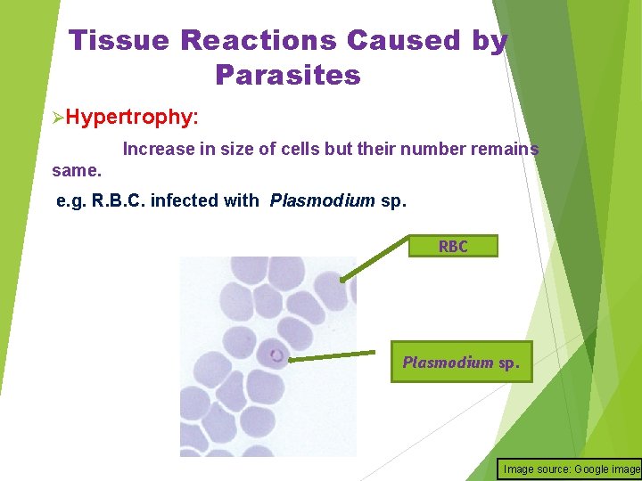 Tissue Reactions Caused by Parasites ØHypertrophy: Increase in size of cells but their number