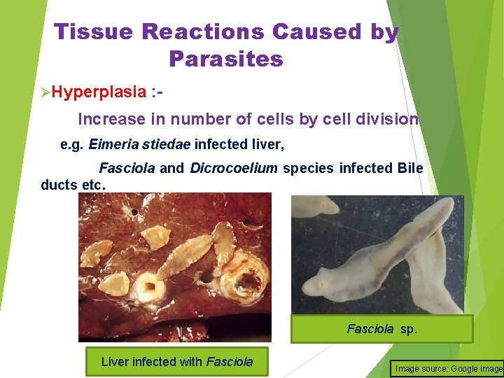 Tissue Reactions Caused by Parasites ØHyperplasia : - Increase in number of cells by