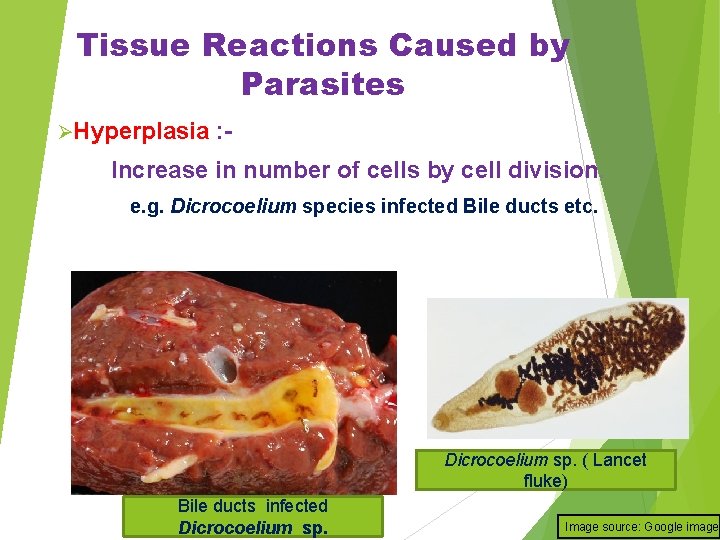 Tissue Reactions Caused by Parasites ØHyperplasia : - Increase in number of cells by