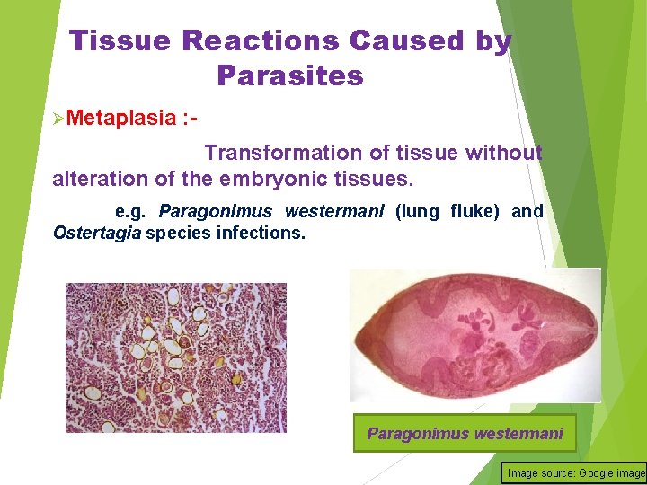 Tissue Reactions Caused by Parasites ØMetaplasia : - Transformation of tissue without alteration of