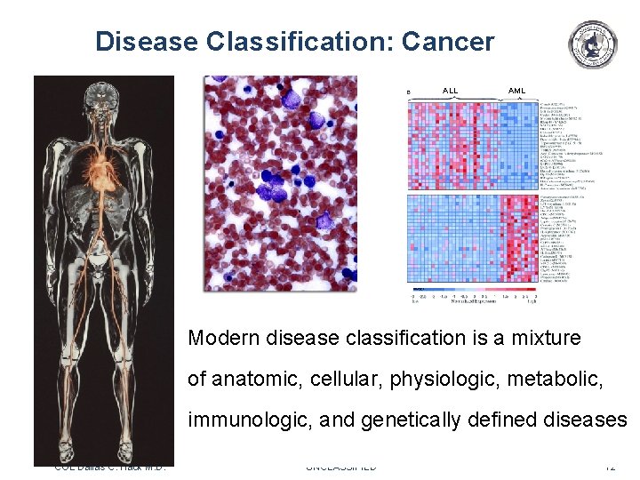 Disease Classification: Cancer ALL AML bioinformatic analyses Modern disease classification is a mixture of Disease Classification: Cancer ALL AML bioinformatic analyses Modern disease classification is a mixture of