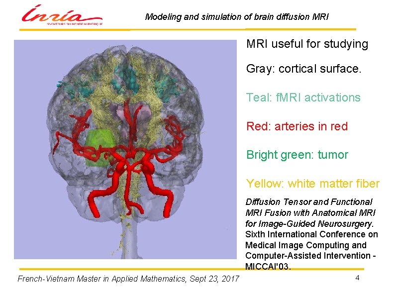 Modeling and simulation of brain diffusion MRI useful for studying Gray: cortical surface. Teal: