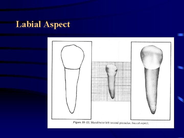 Labial Aspect Labial Aspect