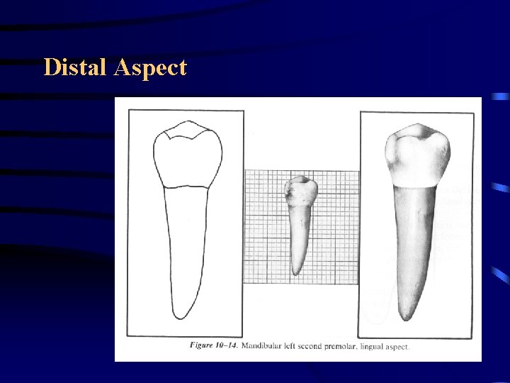 Distal Aspect Distal Aspect