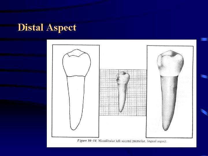 Distal Aspect 