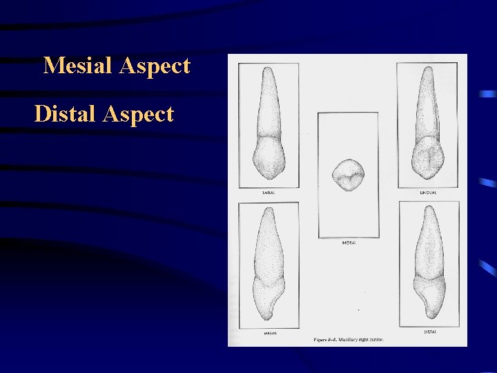 Mesial Aspect Distal Aspect Mesial Aspect Distal Aspect