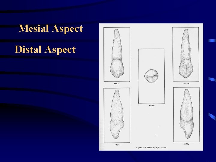 Mesial Aspect Distal Aspect 