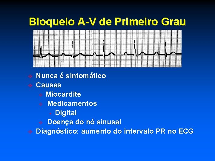 Bloqueio A-V de Primeiro Grau Nunca é sintomático Causas Miocardite Medicamentos Digital Doença do