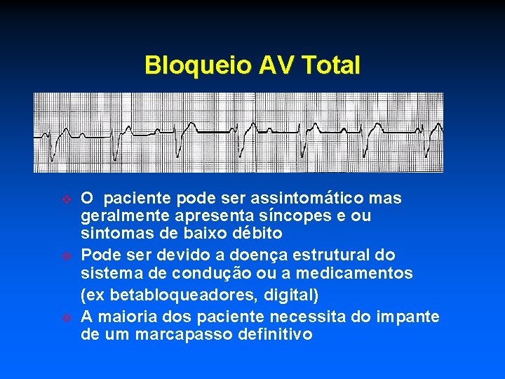 Bloqueio AV Total O paciente pode ser assintomático mas geralmente apresenta síncopes e ou