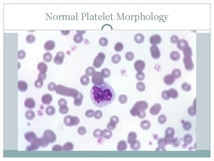 Normal Platelet Morphology 