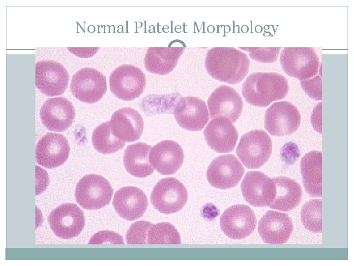 Normal Platelet Morphology 