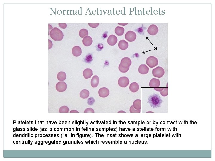 Normal Activated Platelets that have been slightly activated in the sample or by contact