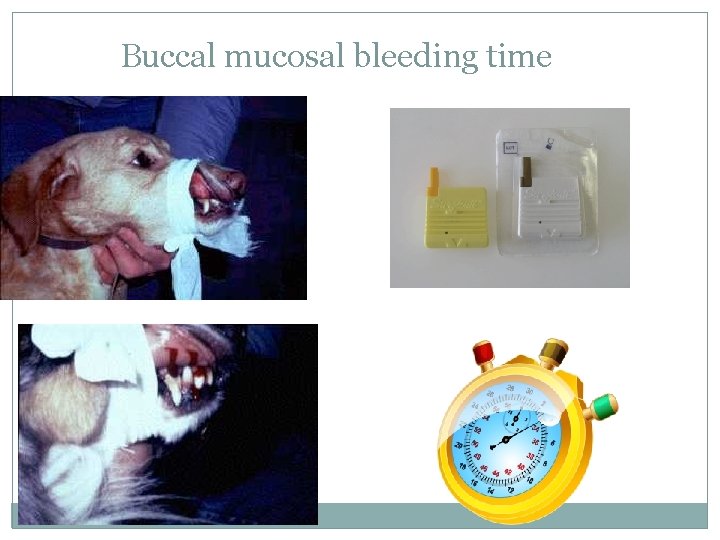 Buccal mucosal bleeding time 