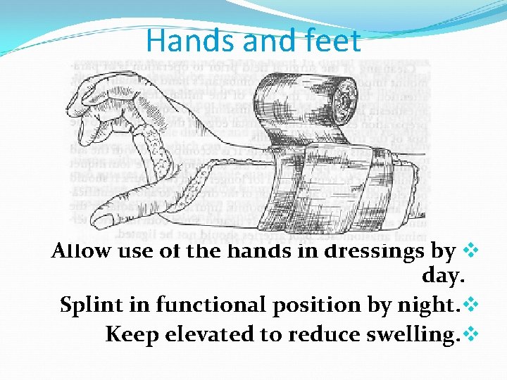 Hands and feet Allow use of the hands in dressings by v day. Splint