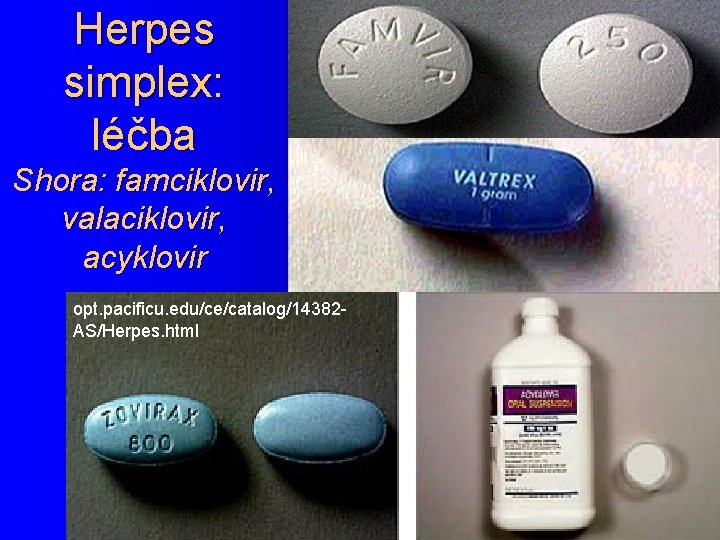 Herpes simplex: léčba Shora: famciklovir, valaciklovir, acyklovir opt. pacificu. edu/ce/catalog/14382 AS/Herpes. html 