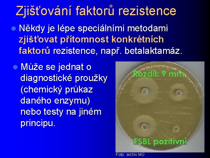 Zjišťování faktorů rezistence l Někdy je lépe speciálními metodami zjišťovat přítomnost konkrétních faktorů rezistence,