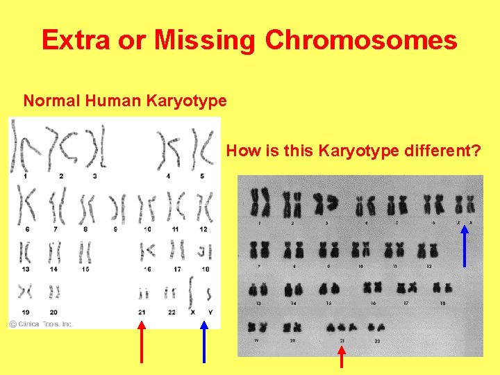 Extra or Missing Chromosomes Normal Human Karyotype How is this Karyotype different? 