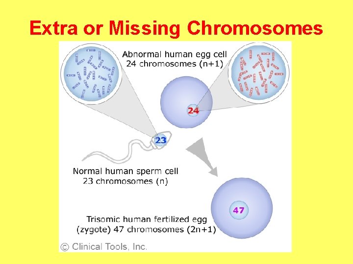 Extra or Missing Chromosomes 