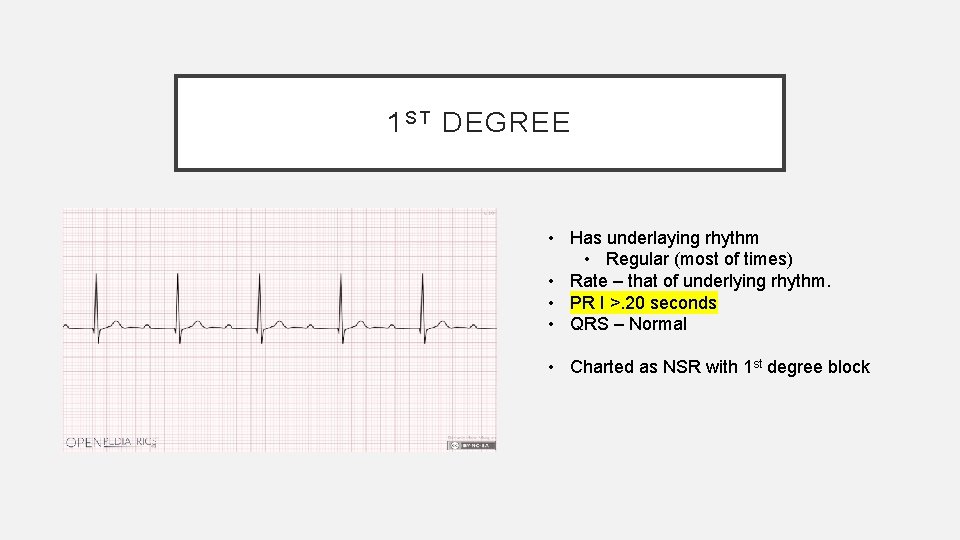 1 S T DEGREE • Has underlaying rhythm • Regular (most of times) •