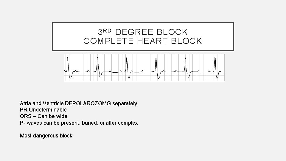 3 R D DEGREE BLOCK COMPLETE HEART BLOCK Atria and Ventricle DEPOLAROZOMG separately PR