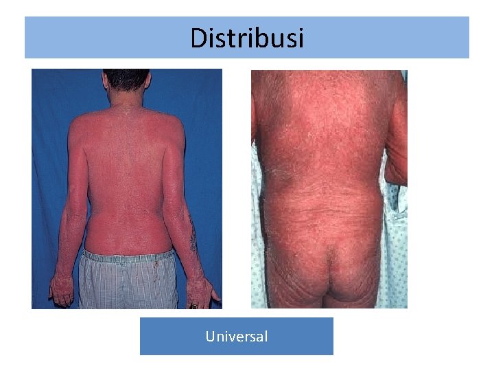 Distribusi Universal 