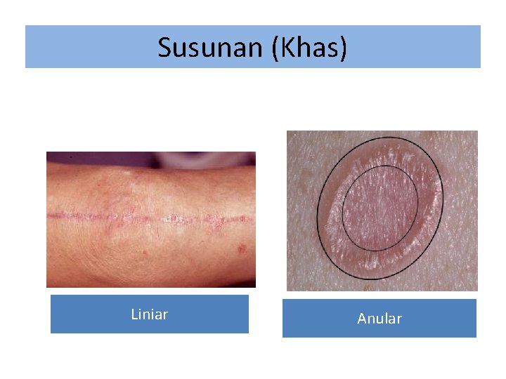 Susunan (Khas) Liniar Anular 