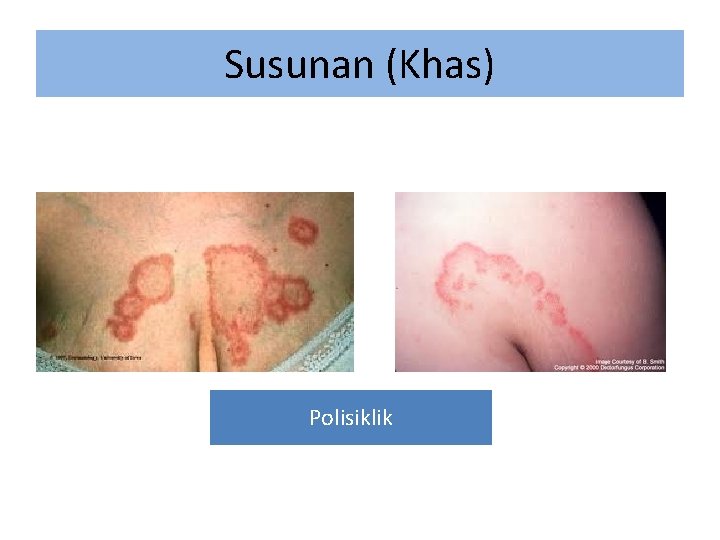 Susunan (Khas) Polisiklik 