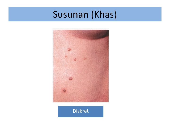 Susunan (Khas) Diskret 
