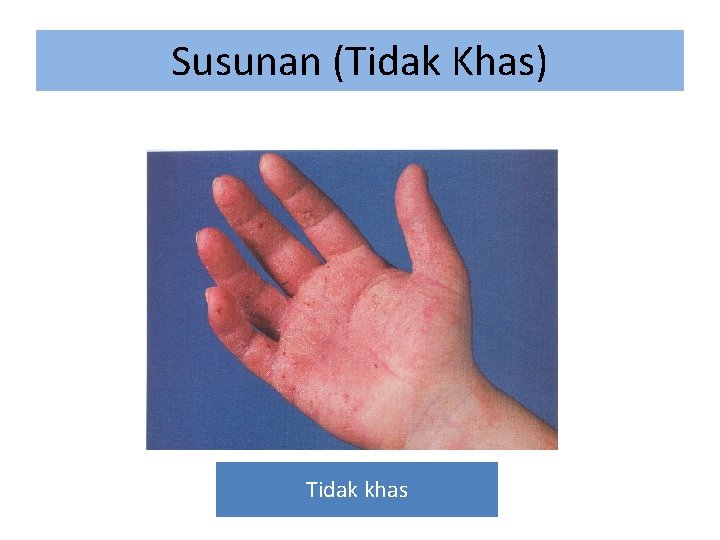 Susunan (Tidak Khas) Tidak khas 