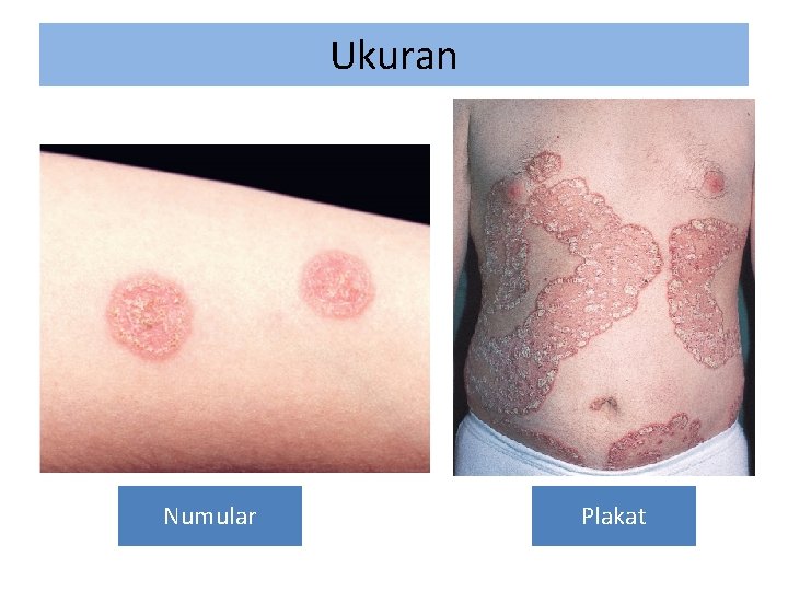 Ukuran Numular Plakat 