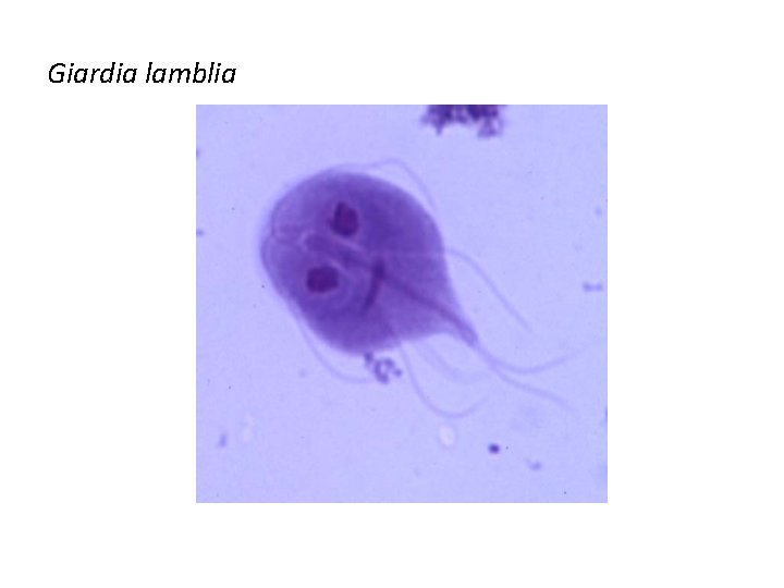 Giardia lamblia 