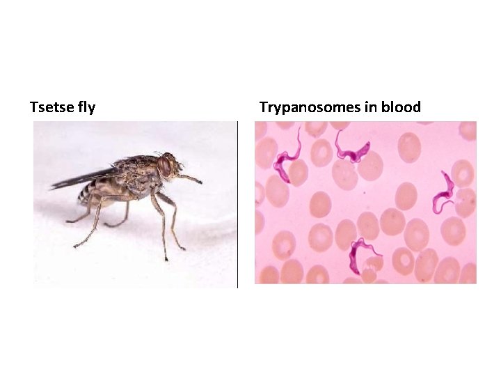 Tsetse fly Trypanosomes in blood 