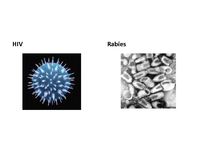 HIV Rabies 