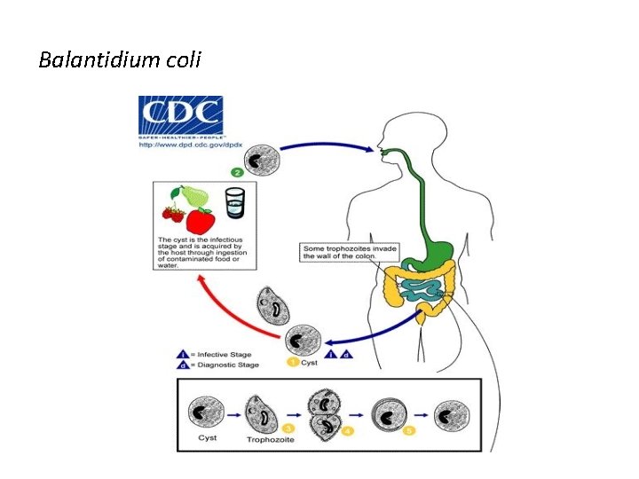 Balantidium coli 