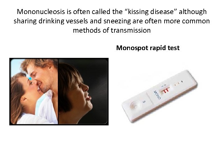 Mononucleosis is often called the “kissing disease” although sharing drinking vessels and sneezing are