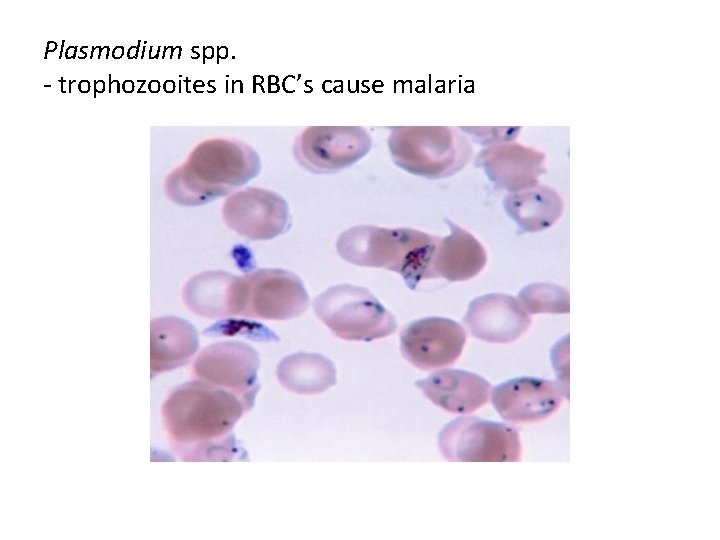 Plasmodium spp. - trophozooites in RBC’s cause malaria 