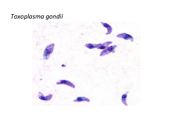 Toxoplasma gondii 
