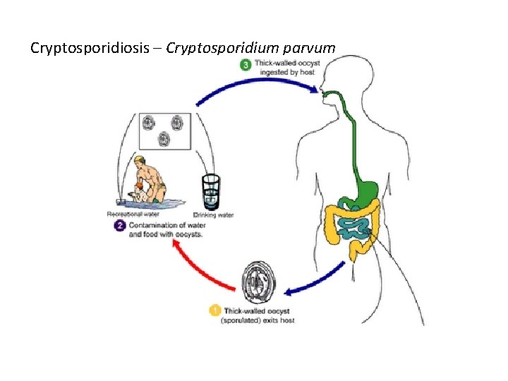 Cryptosporidiosis – Cryptosporidium parvum 