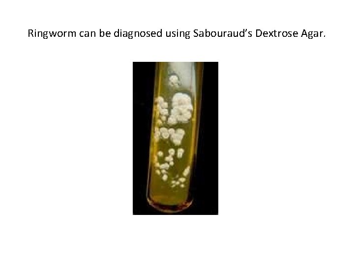 Ringworm can be diagnosed using Sabouraud’s Dextrose Agar. 