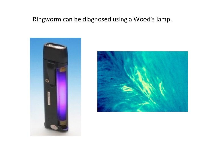 Ringworm can be diagnosed using a Wood’s lamp. 